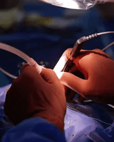 Advanced Cardiac Care